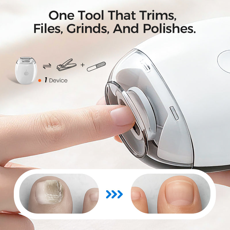 🎁 Kjøp 2 få 1 gratis!💅 Universell Automatisk Neglegrinder - Sikker og Skånsom Neglepleie🥳