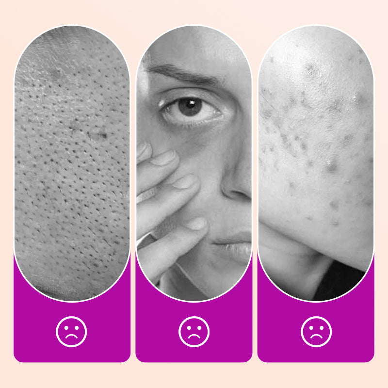 🔥Kjøp 2 få 1 gratis🔥Feilfri lysnende concealer for under øynene