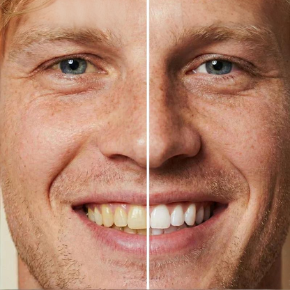 📢📢Kjøp 5, få 5 gratis ⏰5 ml øyeblikkelig tannblekingsfarge