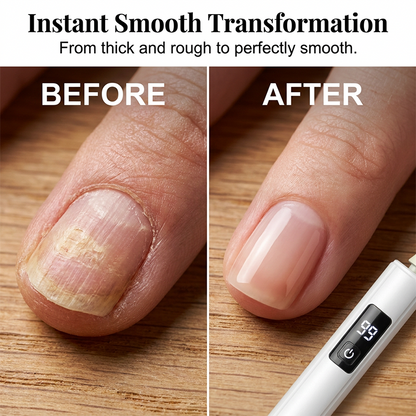 💎 48% RABATT I BEGRENSET TID! ✨Profesjonell elektrisk neglefil – oppgrader neglepleien din med 99 hastigheter og 4 tilbehør ✨💅